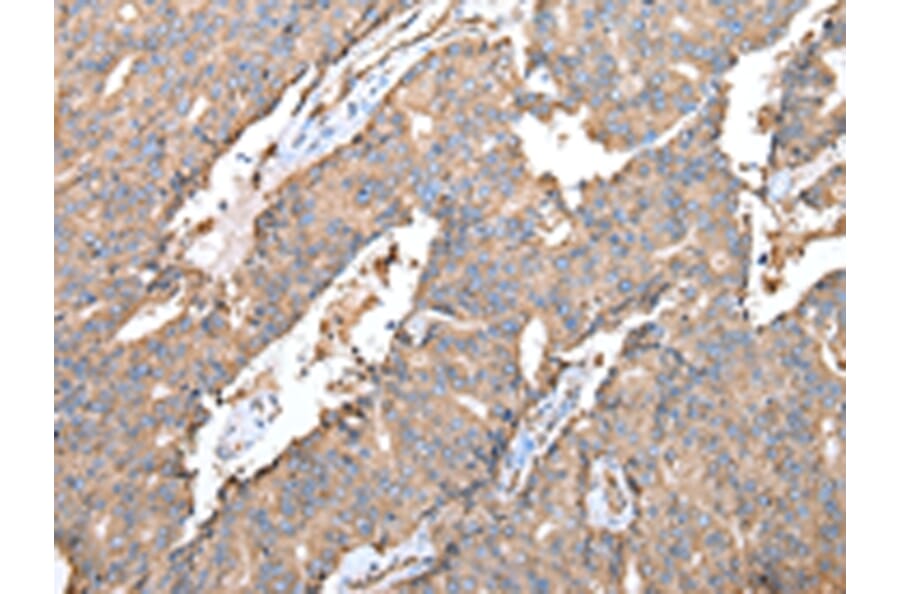 Immunohistochemistry - SPINK7 Antibody from Signalway Antibody (43262) - Antibodies.com