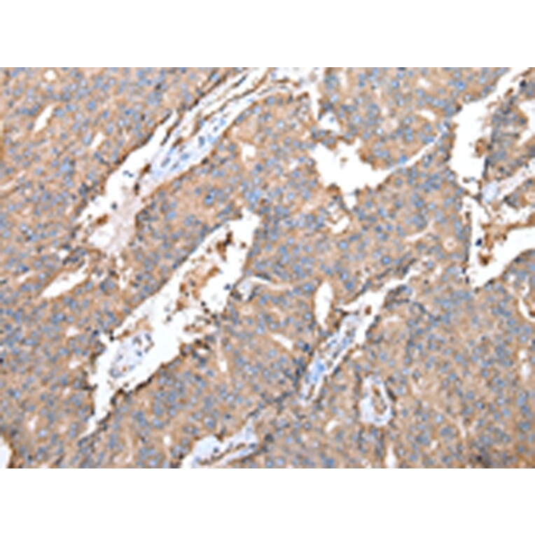 Immunohistochemistry - SPINK7 Antibody from Signalway Antibody (43262) - Antibodies.com