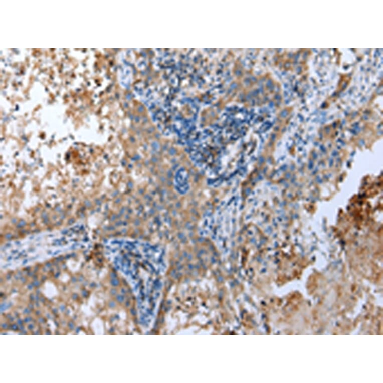 Immunohistochemistry - SPINK7 Antibody from Signalway Antibody (43262) - Antibodies.com
