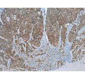 Immunohistochemistry - NDUFB2 Antibody from Signalway Antibody (43285) - Antibodies.com