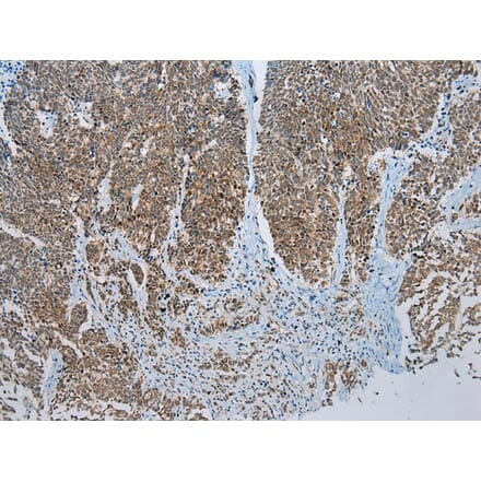 Immunohistochemistry - NDUFB2 Antibody from Signalway Antibody (43285) - Antibodies.com