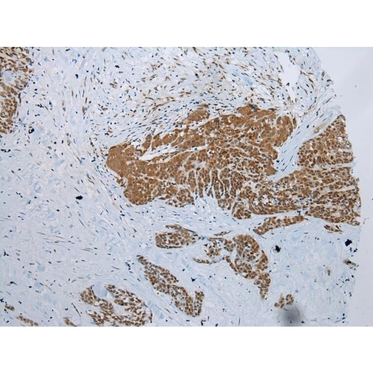 Immunohistochemistry - NDUFB2 Antibody from Signalway Antibody (43285) - Antibodies.com
