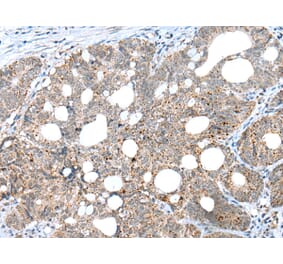 Immunohistochemistry - CLEC4M Antibody from Signalway Antibody (43297) - Antibodies.com