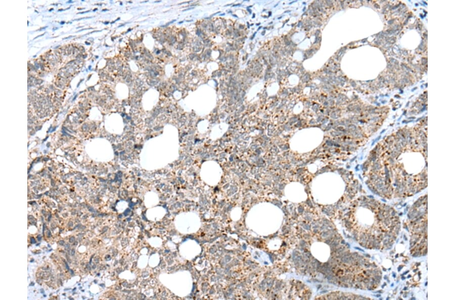 Immunohistochemistry - CLEC4M Antibody from Signalway Antibody (43297) - Antibodies.com