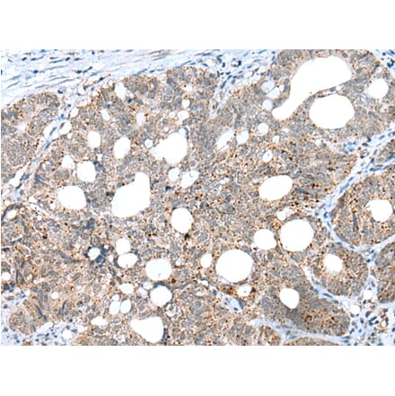 Immunohistochemistry - CLEC4M Antibody from Signalway Antibody (43297) - Antibodies.com