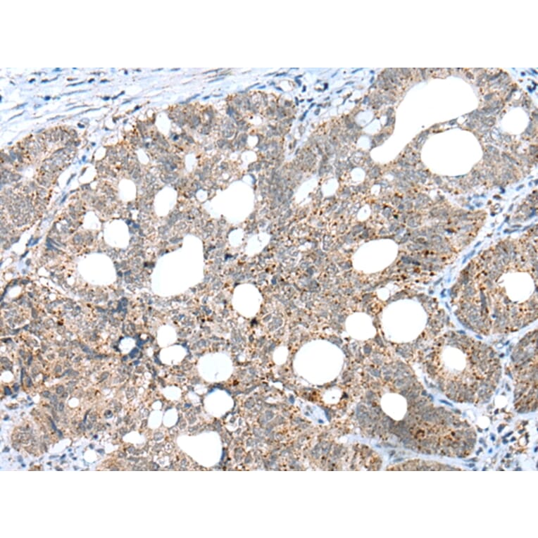 Immunohistochemistry - CLEC4M Antibody from Signalway Antibody (43297) - Antibodies.com