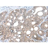 Immunohistochemistry - CLEC4M Antibody from Signalway Antibody (43297) - Antibodies.com