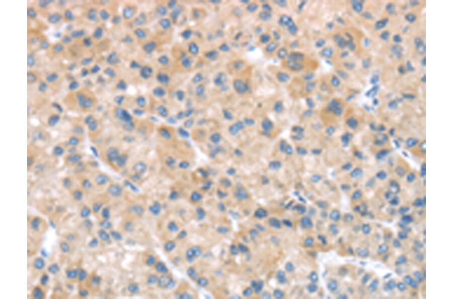 Immunohistochemistry - SFTPA1 Antibody from Signalway Antibody (43332) - Antibodies.com