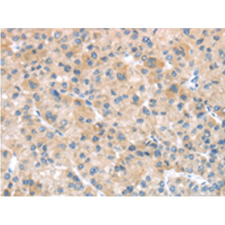 Immunohistochemistry - SFTPA1 Antibody from Signalway Antibody (43332) - Antibodies.com