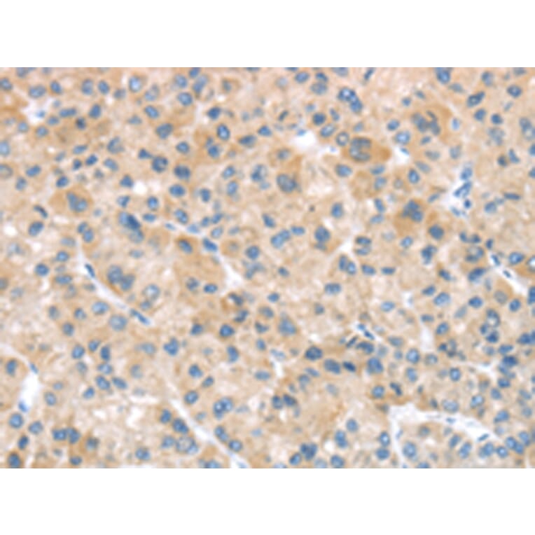 Immunohistochemistry - SFTPA1 Antibody from Signalway Antibody (43332) - Antibodies.com