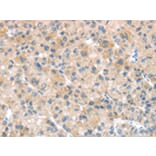 Immunohistochemistry - SFTPA1 Antibody from Signalway Antibody (43332) - Antibodies.com