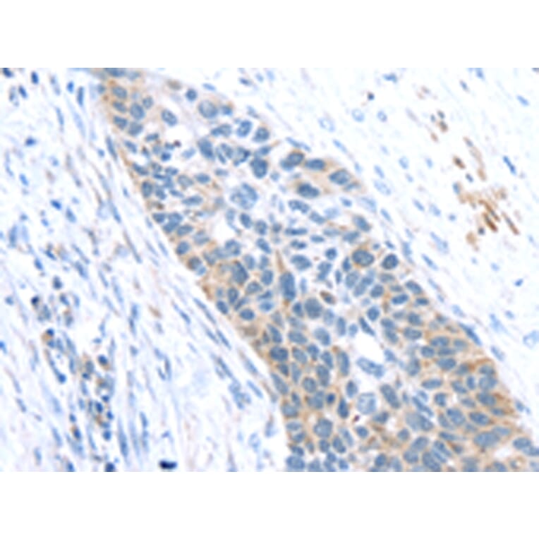 Immunohistochemistry - SFTPA1 Antibody from Signalway Antibody (43332) - Antibodies.com