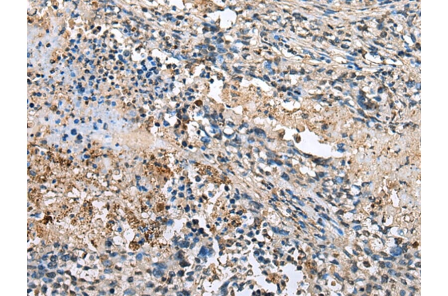 Immunohistochemistry - LMNTD1 Antibody from Signalway Antibody (43355) - Antibodies.com