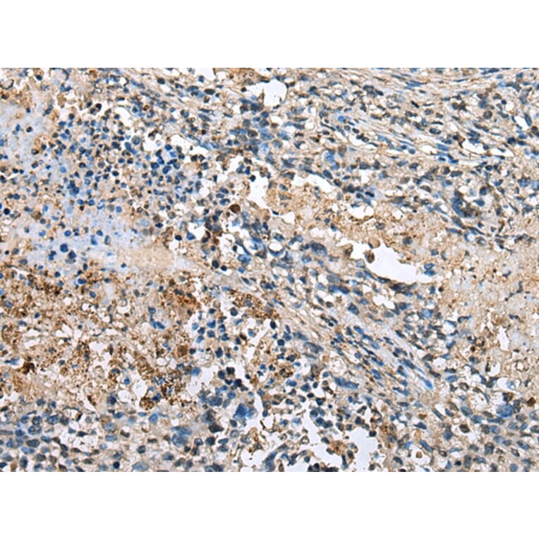 Immunohistochemistry - LMNTD1 Antibody from Signalway Antibody (43355) - Antibodies.com