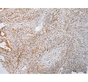 Immunohistochemistry - LYPLA2 Antibody from Signalway Antibody (43391) - Antibodies.com