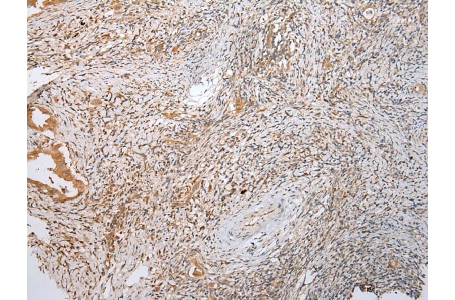 Immunohistochemistry - LYPLA2 Antibody from Signalway Antibody (43391) - Antibodies.com