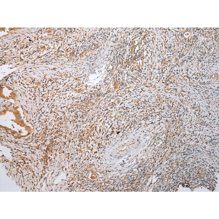 Immunohistochemistry - LYPLA2 Antibody from Signalway Antibody (43391) - Antibodies.com