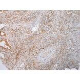 Immunohistochemistry - LYPLA2 Antibody from Signalway Antibody (43391) - Antibodies.com