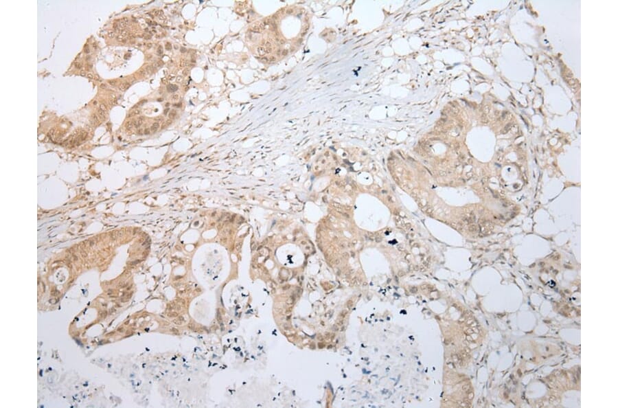 Immunohistochemistry - LYPLA2 Antibody from Signalway Antibody (43391) - Antibodies.com