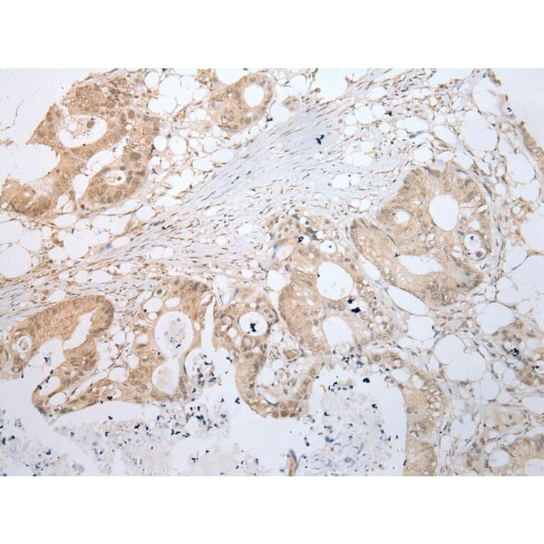 Immunohistochemistry - LYPLA2 Antibody from Signalway Antibody (43391) - Antibodies.com