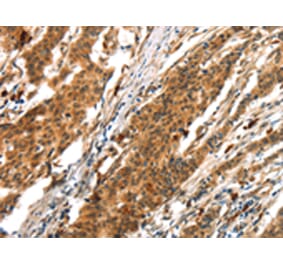 Immunohistochemistry - BCLAF1 Antibody from Signalway Antibody (43411) - Antibodies.com