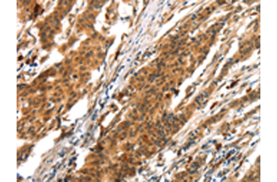 Immunohistochemistry - BCLAF1 Antibody from Signalway Antibody (43411) - Antibodies.com