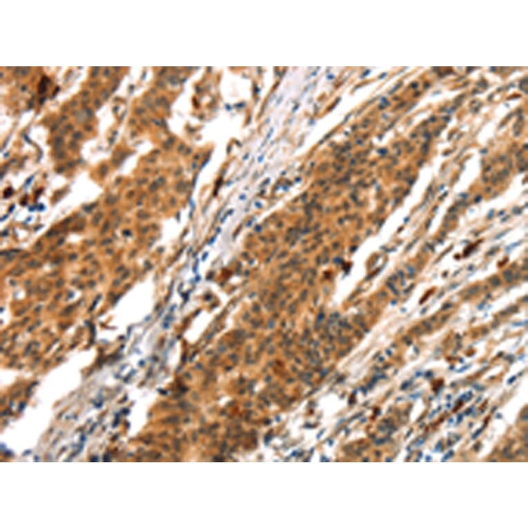 Immunohistochemistry - BCLAF1 Antibody from Signalway Antibody (43411) - Antibodies.com