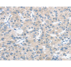 Immunohistochemistry - TM9SF1 Antibody from Signalway Antibody (43421) - Antibodies.com