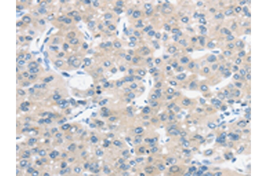 Immunohistochemistry - TM9SF1 Antibody from Signalway Antibody (43421) - Antibodies.com