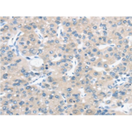 Immunohistochemistry - TM9SF1 Antibody from Signalway Antibody (43421) - Antibodies.com