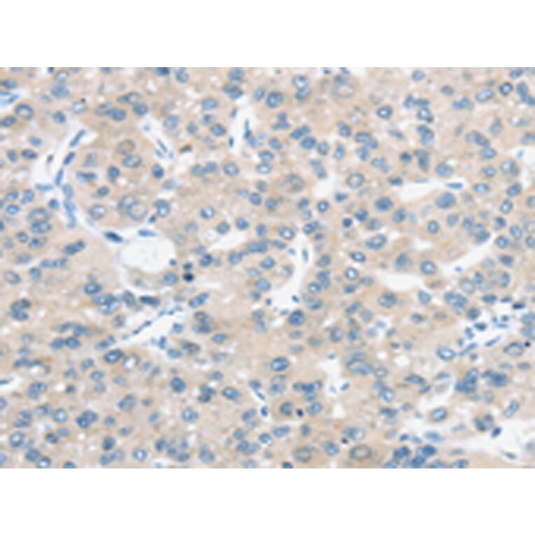 Immunohistochemistry - TM9SF1 Antibody from Signalway Antibody (43421) - Antibodies.com