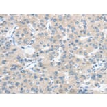 Immunohistochemistry - TM9SF1 Antibody from Signalway Antibody (43421) - Antibodies.com