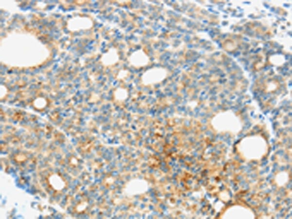 Anti-TM9SF1 Antibody (A45733) | Antibodies.com