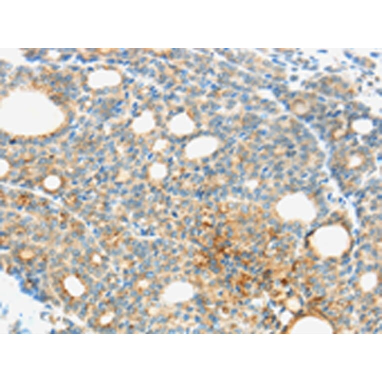 Immunohistochemistry - TM9SF1 Antibody from Signalway Antibody (43421) - Antibodies.com