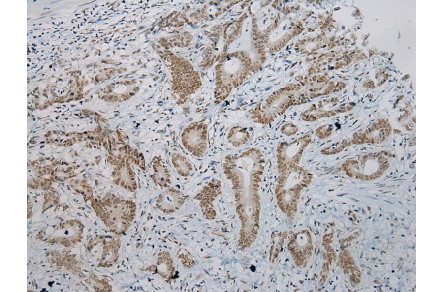 Immunohistochemistry - ZNF473 Antibody from Signalway Antibody (43439) - Antibodies.com