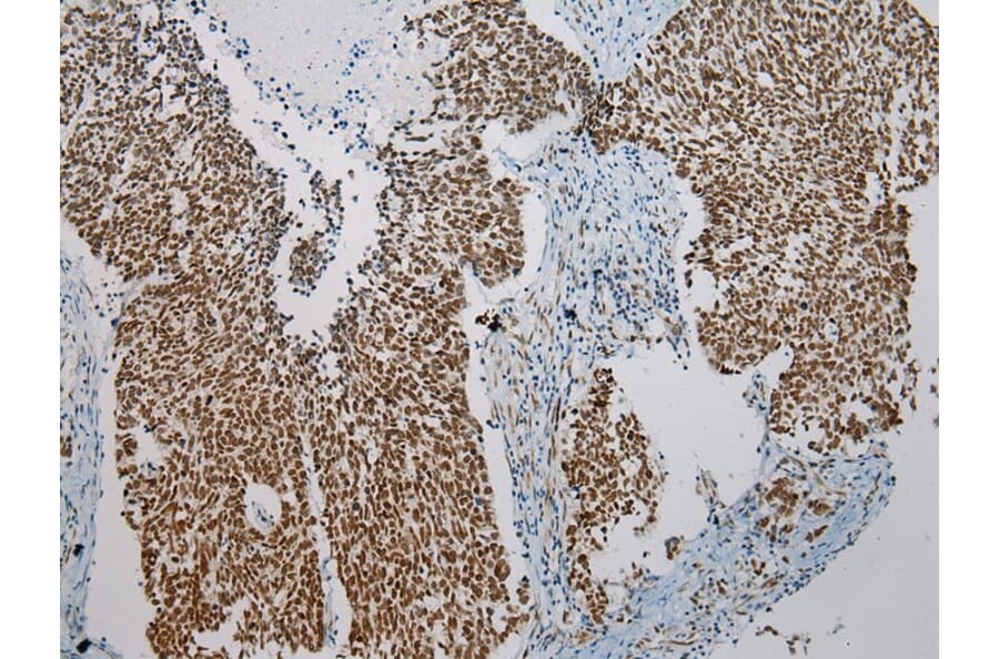 Immunohistochemistry - ZNF473 Antibody from Signalway Antibody (43439) - Antibodies.com