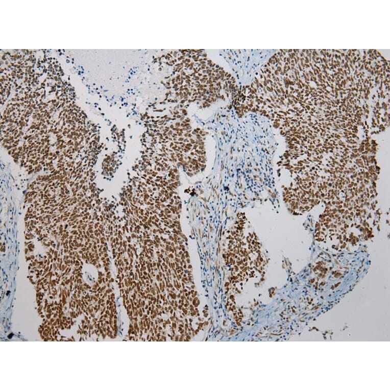 Immunohistochemistry - ZNF473 Antibody from Signalway Antibody (43439) - Antibodies.com