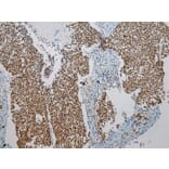 Immunohistochemistry - ZNF473 Antibody from Signalway Antibody (43439) - Antibodies.com