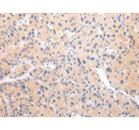 Immunohistochemistry - ZNF106 Antibody from Signalway Antibody (43443) - Antibodies.com