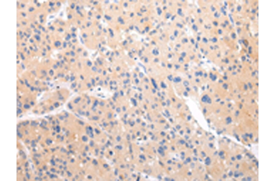 Immunohistochemistry - ZNF106 Antibody from Signalway Antibody (43443) - Antibodies.com