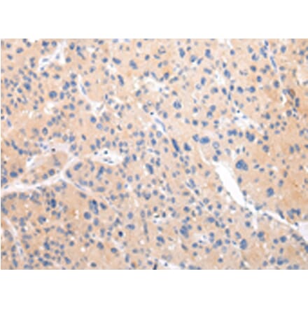 Immunohistochemistry - ZNF106 Antibody from Signalway Antibody (43443) - Antibodies.com