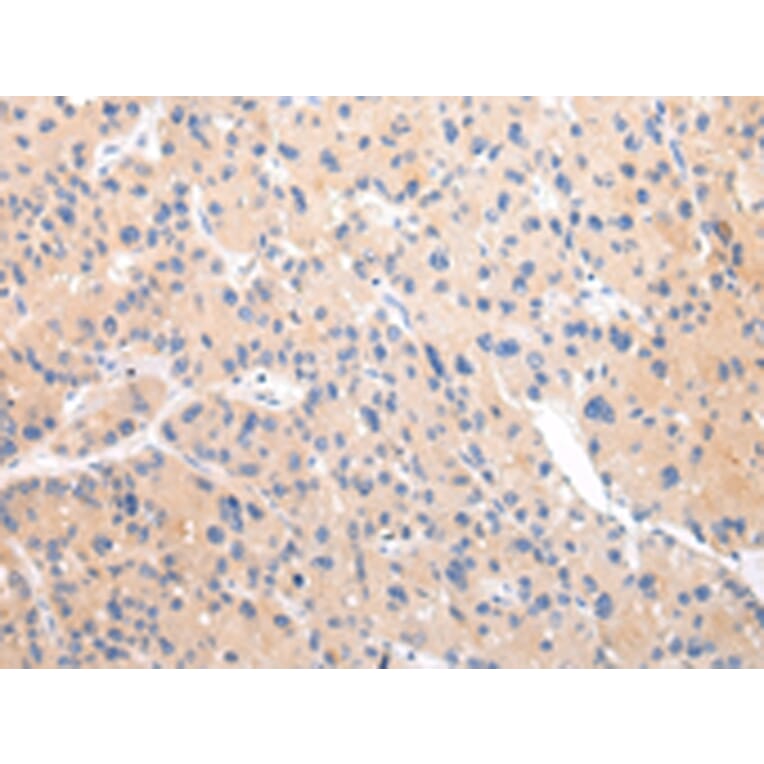 Immunohistochemistry - ZNF106 Antibody from Signalway Antibody (43443) - Antibodies.com