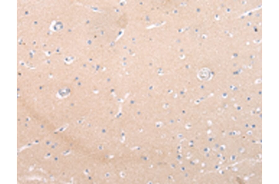Immunohistochemistry - ZNF106 Antibody from Signalway Antibody (43443) - Antibodies.com