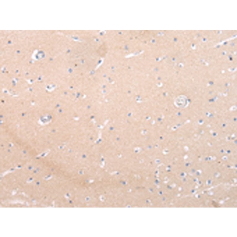 Immunohistochemistry - ZNF106 Antibody from Signalway Antibody (43443) - Antibodies.com