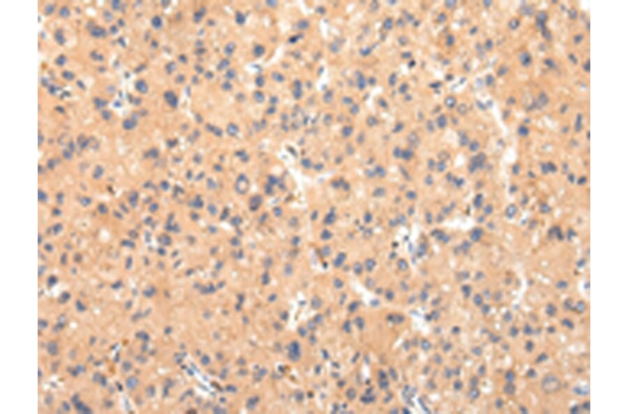 Immunohistochemistry - ATP7B Antibody from Signalway Antibody (43445) - Antibodies.com