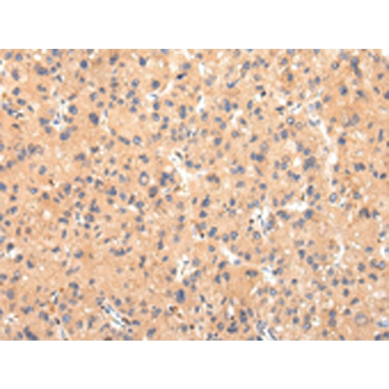 Immunohistochemistry - ATP7B Antibody from Signalway Antibody (43445) - Antibodies.com