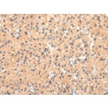 Immunohistochemistry - ATP7B Antibody from Signalway Antibody (43445) - Antibodies.com