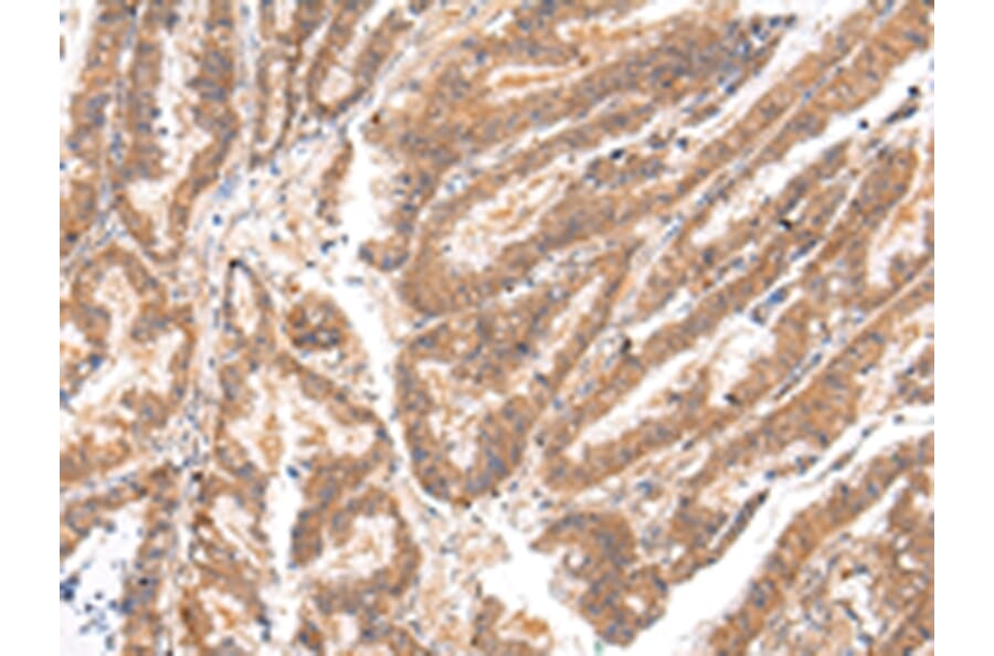 Immunohistochemistry - ATP7B Antibody from Signalway Antibody (43445) - Antibodies.com