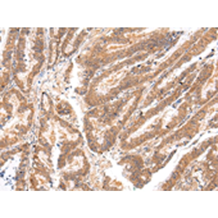 Immunohistochemistry - ATP7B Antibody from Signalway Antibody (43445) - Antibodies.com