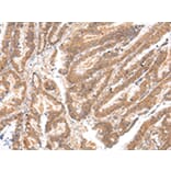 Immunohistochemistry - ATP7B Antibody from Signalway Antibody (43445) - Antibodies.com